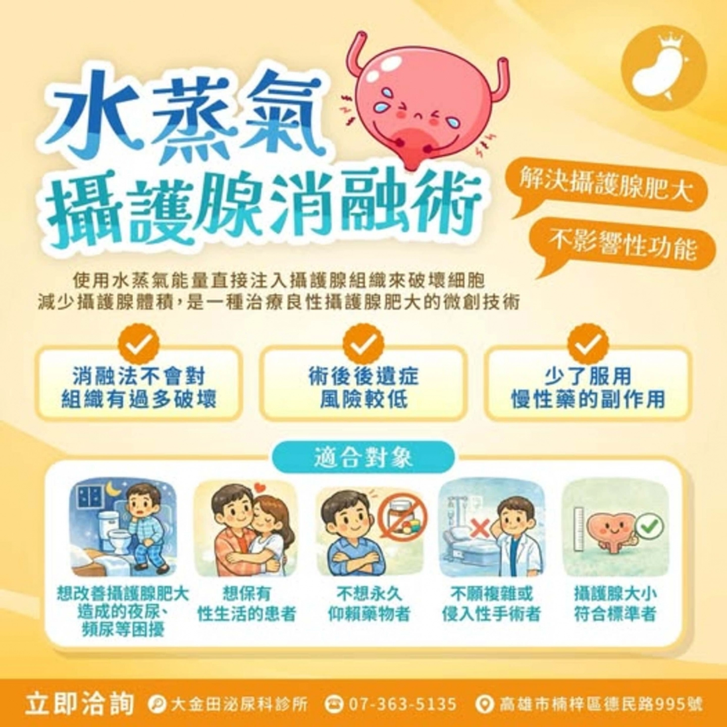 水蒸氣攝護腺消融術